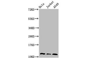 Western Blot Positive WB detected in: Hela whole cell lysate, Jurkat whole cell lysate, A549 whole cell lysate All lanes: TXN antibody at 3 μg/mL Secondary Goat polyclonal to rabbit IgG at 1/50000 dilution Predicted band size: 12, 10 kDa Observed band size: 12 kDa (TXN antibody  (AA 2-105))