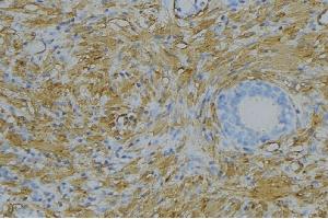 ABIN6279132 at 1/100 staining Human uterus tissue by IHC-P. (Apolipoprotein L 5 antibody  (C-Term))