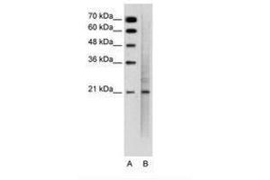 Image no. 2 for anti-Mucin 1 (MUC1) (C-Term) antibody (ABIN6736343) (MUC1 antibody  (C-Term))