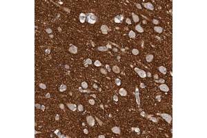 Immunohistochemical staining of human cerebral cortex with EDEM3 polyclonal antibody  shows distinct positivity in neuropil at 1:10-1:20 dilution. (EDEM3 antibody)