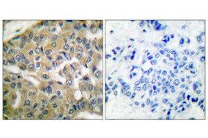 Immunohistochemistry (IHC) image for anti-Fragile Histidine Triad (FHIT) (Internal Region) antibody (ABIN1848544) (FHIT antibody  (Internal Region))