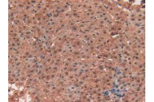 IHC-P analysis of Human Liver Tissue, with DAB staining. (TEK antibody  (AA 1-116))