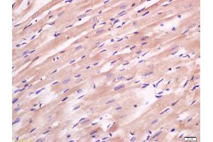 Immunohistochemistry (Paraffin-embedded Sections) (IHC (p)) image for anti-Family with Sequence Similarity 134, Member B (FAM134B) (AA 210-310) antibody (ABIN1714363)