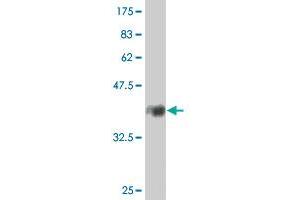 Western Blot detection against Immunogen (38. (PDLIM1 antibody  (AA 123-232))