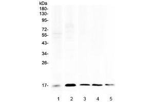 Western blot testing of 1) human placenta, 2) human HeLa, 3) rat spleen, 4) rat RH35 and 5) mouse spleen lysate with Psoriasin antibody at 0.