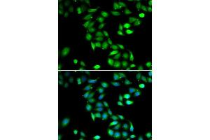 Immunofluorescence analysis of HeLa cells using PDCD6 antibody. (PDCD6 antibody  (AA 1-191))