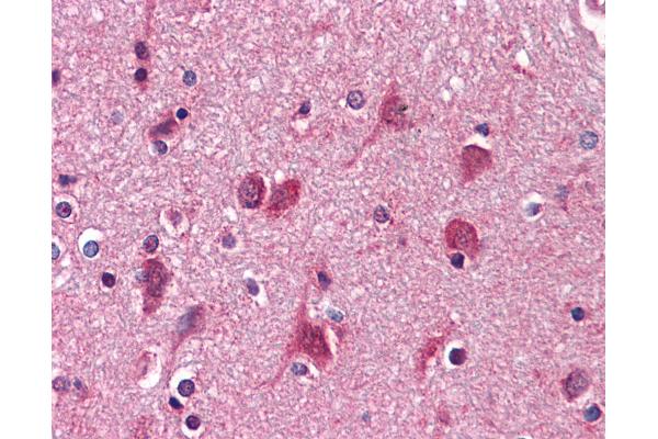 AGPS antibody  (AA 370-628)