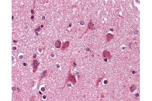 Anti-AGPS antibody IHC of human brain, cortex. (AGPS antibody  (AA 370-628))