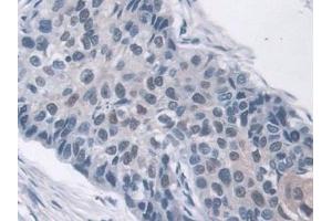 Immunohistochemistry (IHC) image for anti-AHNAK Nucleoprotein (AHNAK) (AA 1-300) antibody (ABIN7436723)
