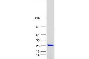 Validation with Western Blot
