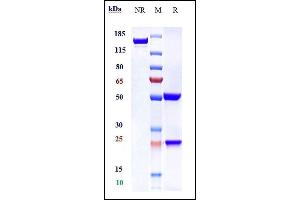 Anti-SLC40A1 Reference Antibody (LY2928057) on SDS-PAGE under reducing (R) condition.