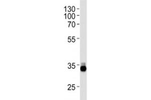 OTX2 antibody western blot analysis in Y79 lysate (OTX2 antibody  (AA 261-289))