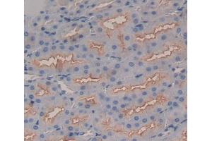 Used in DAB staining on fromalin fixed paraffin- embedded Kidney tissue (Band 3/AE1 antibody  (AA 558-675))