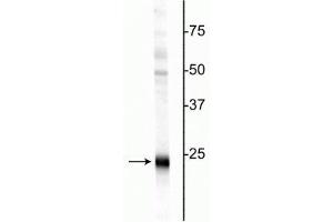 Western blot of rat hippocampal homogenate showing specific immunolabeling of the ~24 kDa UCHL1 protein. (UCHL1 antibody)