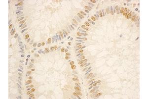 Immunohistochemistry (IHC) image for anti-NOP56 Ribonucleoprotein Homolog (NOP56) (AA 544-594) antibody (ABIN7454854)