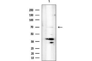 Western blot analysis of lysates from COLO205 cells(heat-shock treatment), using SUN2 Antibody at 1/1000 dilution.