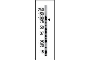 Image no. 1 for anti-Hepatocyte Growth Factor-Regulated tyrosine Kinase Substrate (HGS) (N-Term) antibody (ABIN357582)
