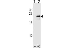 Western Blotting (WB) image for anti-Neurogenin 3 (NEUROG3) antibody (ABIN3001396) (Neurogenin 3 antibody)