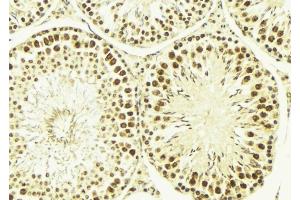 ABIN6269184 at 1/100 staining Mouse testis tissue by IHC-P. (ELK1 antibody  (C-Term))