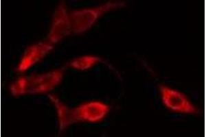 ABIN6275169 staining HeLa cells by IF/ICC. (GIMAP4 antibody  (Internal Region))