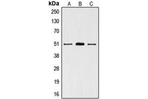 Western blot analysis of VDR expression in HeLa (A), T47D (B), MCF7 (C) whole cell lysates.