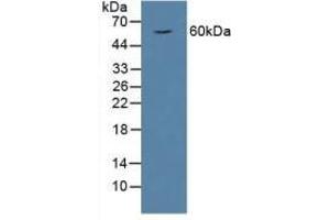 Detection of HPSE in Rat Serum using Polyclonal Antibody to Heparanase (HPSE) (HPSE antibody  (AA 40-188))