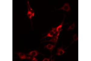 CBLN1 antibody  (C-Term)