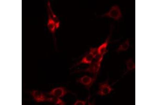 CBLN1 antibody  (C-Term)