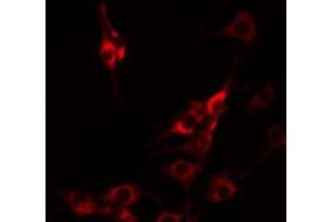 ABIN6274994 staining HuvEc by IF/ICC. (CBLN1 antibody  (C-Term))