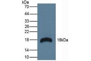 Detection of RNASE3 in Mouse Lymphonodus Tissue using Polyclonal Antibody to Ribonuclease A3 (RNASE3) (RNASE3 antibody  (AA 34-150))