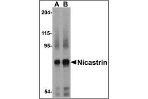 Western blot analysis of Nicastrin in human brain tissue lysate with this product at (A) 0.