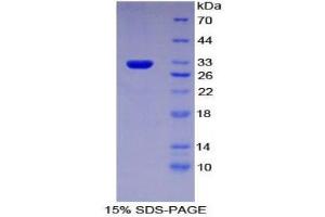 SDS-PAGE (SDS) image for ATP-Binding Cassette, Sub-Family C (CFTR/MRP), Member 1 (ABCC1) (AA 1219-1469) protein (His tag) (ABIN1879083)