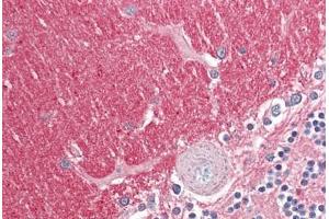 Image no. 2 for anti-Guanine Nucleotide Binding Protein (G Protein), beta Polypeptide 3 (GNB3) (AA 309-321) antibody (ABIN1496050) (GNB3 antibody  (AA 309-321))