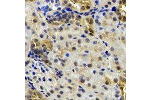 Immunohistochemical analysis of B9D1 staining in rat kidney formalin fixed paraffin embedded tissue section. (B9D1 antibody)
