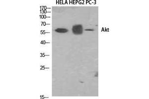Western Blot (WB) analysis of HELA, HepG2, PC-3 using Akt1 Polyclonal Antibody. (AKT1 antibody  (N-Term))