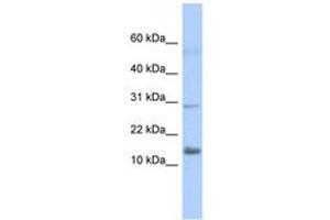 Image no. 1 for anti-Interferon, alpha-Inducible Protein 27-Like 2 (IFI27L2) (AA 71-120) antibody (ABIN6743538) (IFI27L2 antibody  (AA 71-120))