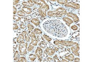 IHC analysis of CBS using anti-CBS antibody (ABIN7599637). (CBS antibody  (AA 102-342))
