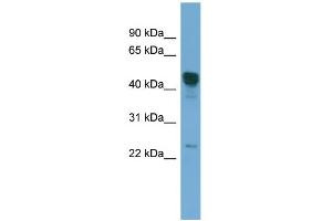 WB Suggested Anti-DYX1C1 Antibody Titration: 0.