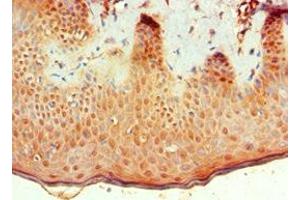 Immunohistochemistry of paraffin-embedded human skin tissue using ABIN7145683 at dilution of 1:100 (BMP15 antibody  (AA 143-392))