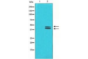 Western blot analysis of ERK1/2 phosphorylation expression in HeLa whole cell lysates,The lane on the left is treated with the antigen-specific peptide. (ERK1 antibody  (pThr202, pTyr204))