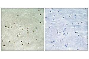 Immunohistochemical staining of human brain (left). (MCM4 antibody  (pSer54))