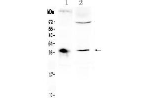 Western blot analysis of CD151 using anti- CD151 antibody . (CD151 antibody  (AA 113-175))