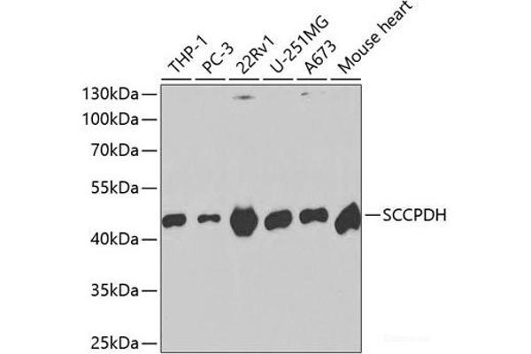 SCCPDH antibody