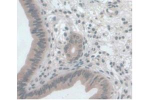 DAB staining on IHC-P Samples:Mouse Uterus Tissue) (CCL2 antibody  (AA 24-96))