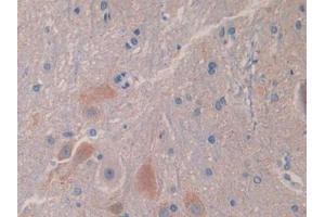 Detection of IL18BP in Rat Spinal cord Tissue using Polyclonal Antibody to Interleukin 18 Binding Protein (IL18BP) (IL18BP antibody  (AA 29-193))