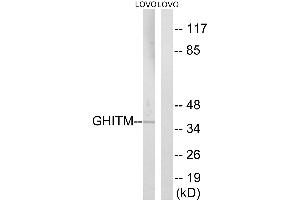 Western blot analysis of extracts from LOVO cells, using GHITM antibody.