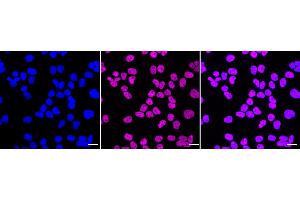 Immunocytochemical staining of HeLa cells with C-terminal binding protein 2 antibody (ABIN7797816), 1:1,000). (Recombinant CTBP2 antibody)