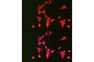Immunofluorescence (IF) image for anti-Ribosomal Protein S6 Kinase, 70kDa, Polypeptide 1 (RPS6KB1) (AA 361-525) antibody (ABIN7270029)