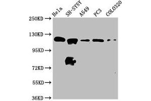 Western Blot Positive WB detected in: Hela whole cell lysate, SH-SY5Y whole cell lysate, A549 whole cell lysate, PC-3 whole cell lysate, COLO320 whole cell lysate All lanes: MAML2 antibody at 2. (MAML2 antibody  (AA 347-506))