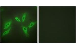 Immunofluorescence analysis of HeLa cells, using TUSC3 Antibody. (TUSC3 antibody  (AA 131-180))